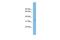 Signal Sequence Receptor Subunit 1 antibody, GTX46555, GeneTex, Western Blot image 