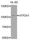 ATPase Sarcoplasmic/Endoplasmic Reticulum Ca2+ Transporting 1 antibody, abx136014, Abbexa, Western Blot image 
