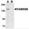 GRB2 Associated Regulator Of MAPK1 Subtype 2 antibody, MBS151417, MyBioSource, Western Blot image 