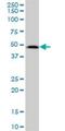 SDS3 Homolog, SIN3A Corepressor Complex Component antibody, H00064426-B01P, Novus Biologicals, Western Blot image 