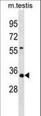 Tissue Specific Transplantation Antigen P35B antibody, LS-C158282, Lifespan Biosciences, Western Blot image 