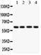 Beta-hexosaminidase subunit alpha antibody, PA5-79358, Invitrogen Antibodies, Western Blot image 