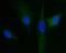 Hepatocyte Growth Factor-Regulated Tyrosine Kinase Substrate antibody, M01174-2, Boster Biological Technology, Immunofluorescence image 