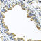 Serpin Family A Member 3 antibody, 13-502, ProSci, Immunohistochemistry paraffin image 