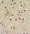 Paired Box 4 antibody, LS-C163389, Lifespan Biosciences, Immunohistochemistry paraffin image 