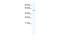 RELB Proto-Oncogene, NF-KB Subunit antibody, 28-749, ProSci, Western Blot image 