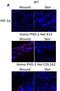 HIF1-alpha antibody, NB100-479, Novus Biologicals, Immunohistochemistry frozen image 