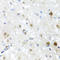 Scaffold Attachment Factor B2 antibody, A06911, Boster Biological Technology, Immunohistochemistry paraffin image 