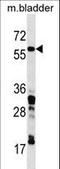 Coronin 1C antibody, LS-C159396, Lifespan Biosciences, Western Blot image 