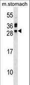 Troponin I3, Cardiac Type antibody, LS-C157238, Lifespan Biosciences, Western Blot image 