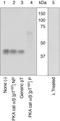 Protein Kinase C Beta antibody, GTX25785, GeneTex, Western Blot image 