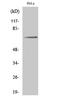 Paxillin antibody, A01033Y31, Boster Biological Technology, Western Blot image 
