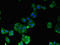 15-Hydroxyprostaglandin Dehydrogenase antibody, orb47415, Biorbyt, Immunofluorescence image 