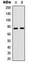 CD180 antigen antibody, LS-B13462, Lifespan Biosciences, Western Blot image 