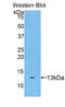 ADAM Metallopeptidase With Thrombospondin Type 1 Motif 7 antibody, LS-C302655, Lifespan Biosciences, Western Blot image 