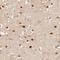 Ribophorin II antibody, NBP2-38323, Novus Biologicals, Immunohistochemistry frozen image 