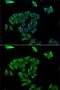 Transglutaminase 3 antibody, GTX33543, GeneTex, Immunocytochemistry image 