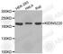 Kinase D Interacting Substrate 220 antibody, A3473, ABclonal Technology, Western Blot image 