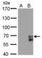 Zinc Finger Protein 703 antibody, NBP2-43777, Novus Biologicals, Western Blot image 