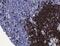 CD79a antibody, MA5-16344, Invitrogen Antibodies, Immunohistochemistry paraffin image 