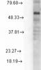 Gamma-Aminobutyric Acid Type A Receptor Delta Subunit antibody, NBP1-47616, Novus Biologicals, Western Blot image 