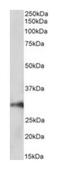 Homeobox A5 antibody, orb233667, Biorbyt, Western Blot image 