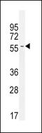 Inhibin Subunit Beta A antibody, LS-C165241, Lifespan Biosciences, Western Blot image 