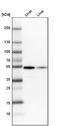 Glutamic--Pyruvic Transaminase antibody, NBP1-89111, Novus Biologicals, Western Blot image 