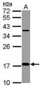 Microtubule Associated Protein 1 Light Chain 3 Beta antibody, PA5-30598, Invitrogen Antibodies, Western Blot image 