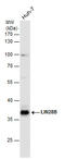 Lin-28 Homolog B antibody, GTX131546, GeneTex, Western Blot image 