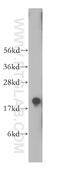 Protein Phosphatase 3 Regulatory Subunit B, Beta antibody, 14005-1-AP, Proteintech Group, Western Blot image 