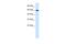 Dachshund Family Transcription Factor 2 antibody, A11176, Boster Biological Technology, Western Blot image 