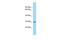 Cementum Protein 1 antibody, PA5-45802, Invitrogen Antibodies, Western Blot image 