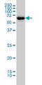 Checkpoint Kinase 2 antibody, LS-B6212, Lifespan Biosciences, Western Blot image 