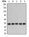 Protein Disulfide Isomerase Family A Member 6 antibody, LS-B14473, Lifespan Biosciences, Western Blot image 
