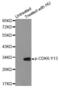 Cyclin Dependent Kinase 6 antibody, MBS128340, MyBioSource, Western Blot image 