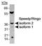 Speedy/RINGO Cell Cycle Regulator Family Member A antibody, NB100-2521, Novus Biologicals, Western Blot image 