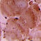 Troponin I3, Cardiac Type antibody, LS-C358371, Lifespan Biosciences, Immunohistochemistry paraffin image 