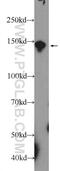 POM121 Transmembrane Nucleoporin antibody, 15645-1-AP, Proteintech Group, Western Blot image 