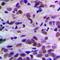 Cyclin Dependent Kinase 2 antibody, orb213711, Biorbyt, Immunohistochemistry paraffin image 