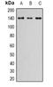 Zinc Finger Protein 335 antibody, orb382493, Biorbyt, Western Blot image 