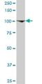 General Transcription Factor IIIC Subunit 3 antibody, H00009330-D01P, Novus Biologicals, Western Blot image 