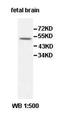 Interleukin-34 antibody, orb77910, Biorbyt, Western Blot image 