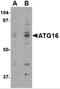 Autophagy Related 16 Like 1 antibody, 4427, ProSci, Western Blot image 