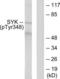 Spleen Associated Tyrosine Kinase antibody, LS-C199623, Lifespan Biosciences, Western Blot image 