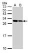 Nucleolar Protein 3 antibody, GTX111883, GeneTex, Western Blot image 