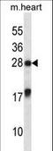 MAX Interactor 1, Dimerization Protein antibody, LS-C164693, Lifespan Biosciences, Western Blot image 