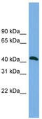 Ankyrin repeat and MYND domain-containing protein 2 antibody, TA344795, Origene, Western Blot image 