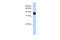 Single Stranded DNA Binding Protein 3 antibody, 27-002, ProSci, Enzyme Linked Immunosorbent Assay image 