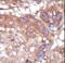 Activated CDC42 kinase 1 antibody, LS-C99164, Lifespan Biosciences, Immunohistochemistry paraffin image 